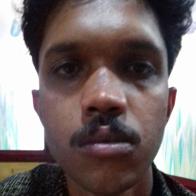  Rhinoplasty pauls-ent-care