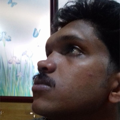  Rhinoplasty pauls-ent-care